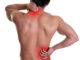 the most common causes of back pain