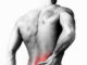 how long sciatica lasts for