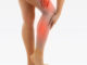 leg pain basics